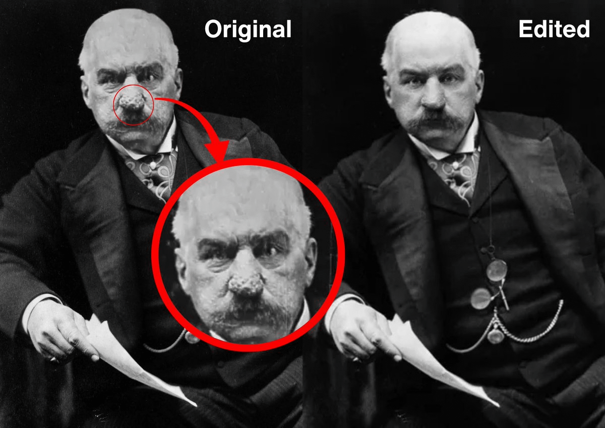 jgreyfriend's tweet image. • be J.P. Morgan
• born 1837, rich kid who decided "rich" wasn't enough
• sickly youth, rheumatic fever, grows up to be a tank of a man
• develops a nose so purple and bulbous he hates mirrors
• chases photographers down the street with a cane if they get too close
•…