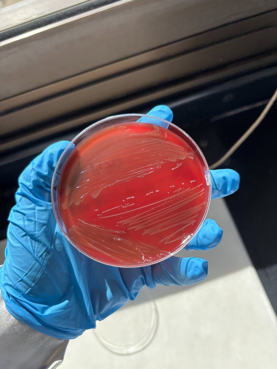 🧪🦠 Seguimos avanzando: Álvaro y Lucía (2.º BIE) han realizado en la ULE cultivos, antibiogramas y caracterización genética de los aislados de Streptococcus suis . 💊🧬
#BIE #somosBIEsomosCiencia #proyectoantibióticos #ieslossauces #benavente #unileon <a href="/sauces49000391/">IES LOS SAUCES</a> <a href="/unileon/">Universidad de León</a>