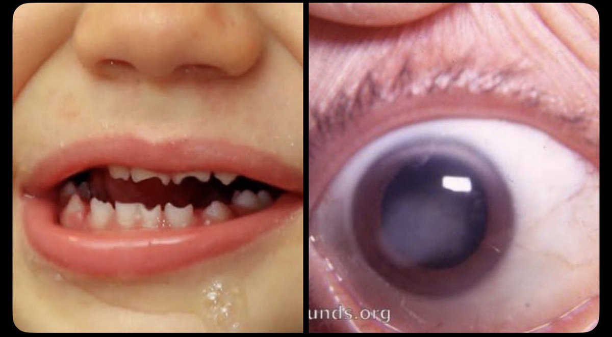 doctors_squad's tweet image. What’s your diagnosis???