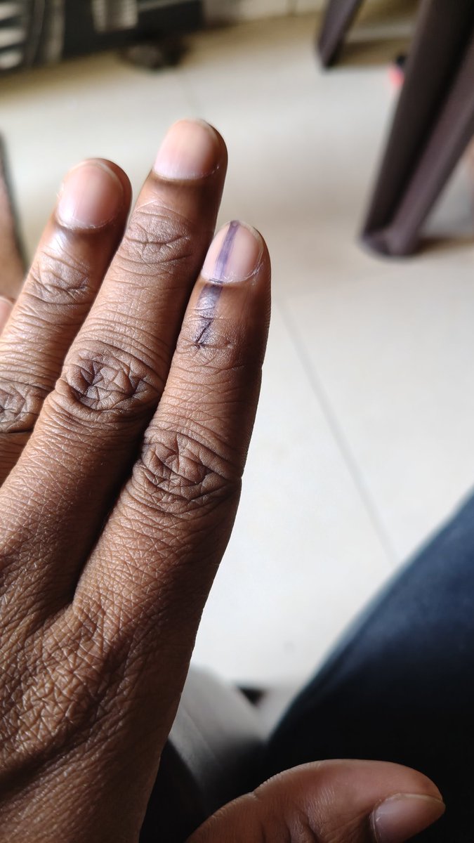 Abhi4204's tweet photo. A serious irregularity has been observed during voting.
Markers are being used instead of approved indelible ink, which is against election rules.
Ward: 15/248
Assembly No.: 188/420/726
Polling Booth: 29, Building No. 2, Agri Shikshan Sanstha, Khanda Colony, Room No. 2
@ECISVEEP https://t.co/UTl3hzLqSP
