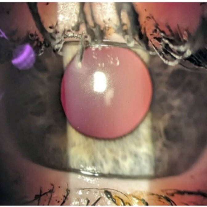 Piotr Futyma, MD tweet media