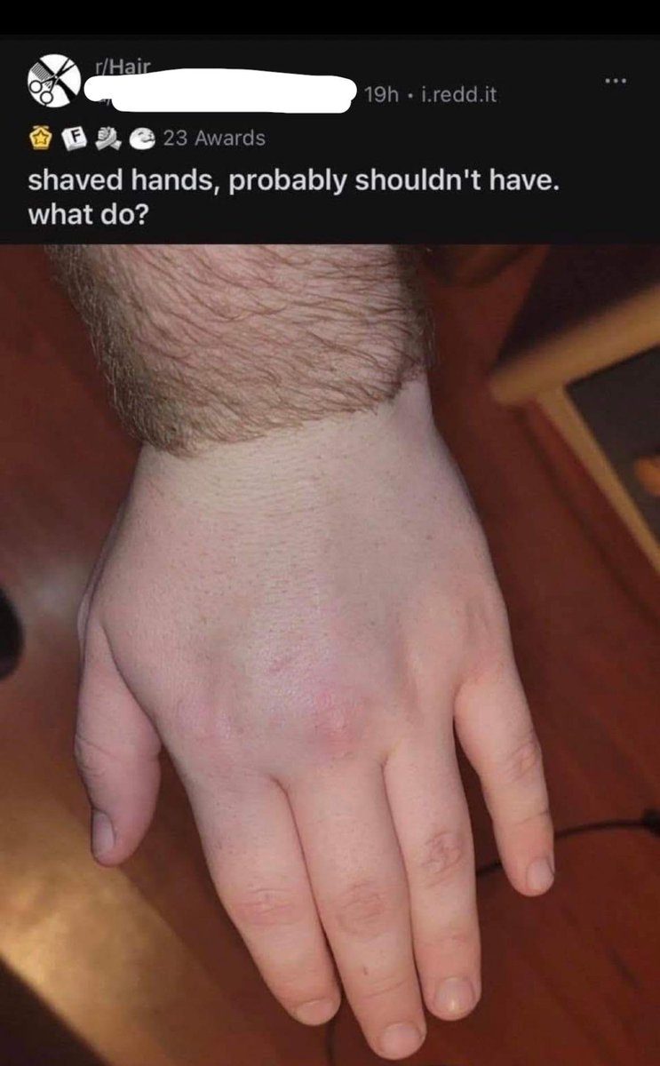 Images That Make You Feel Pain tweet media