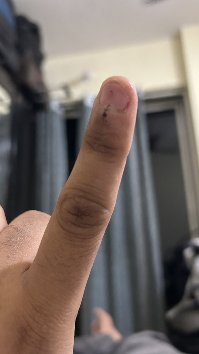 NITESH AGRAWAL tweet media