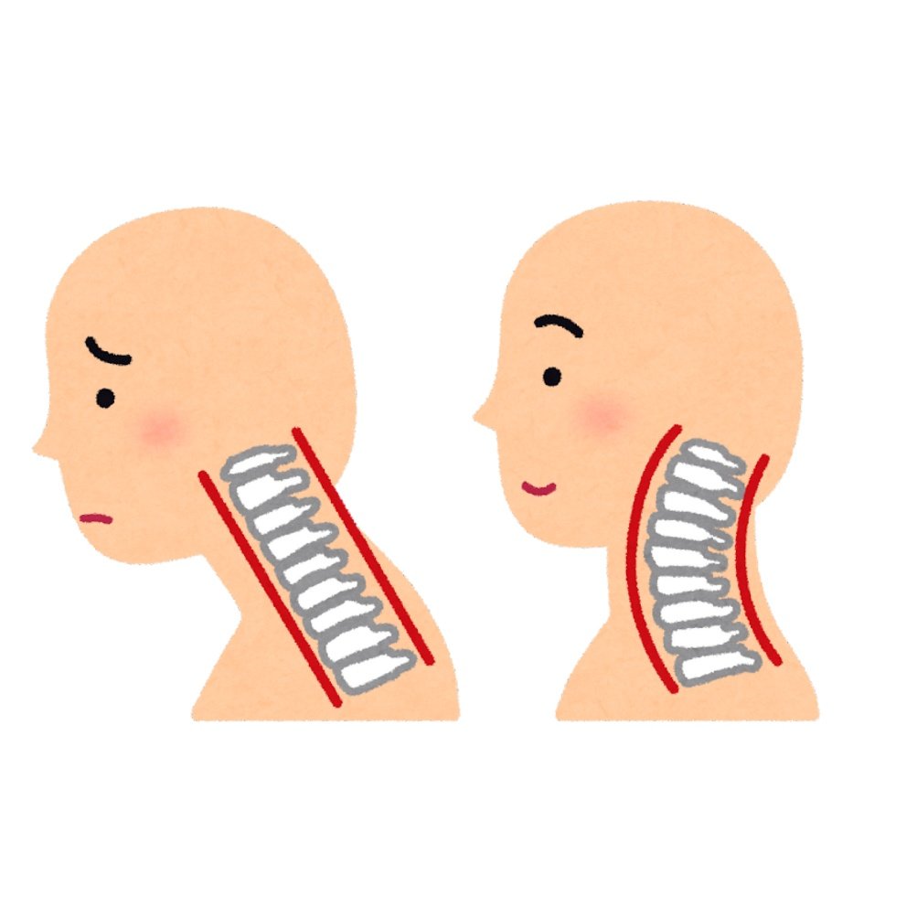 mone_biyouota's tweet image. ストレートネックで首ガッチガチな人、これやって👇🏻前・後ろ・横ぜんぶほぐれて、終わったあとの首の軽さほんと違う。「え、首ってこんな動いたっけ？」ってなるやつ✨