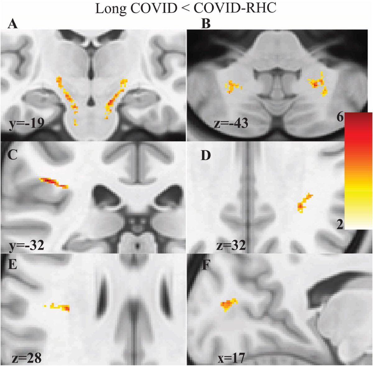 Vipin M. Vashishtha tweet media