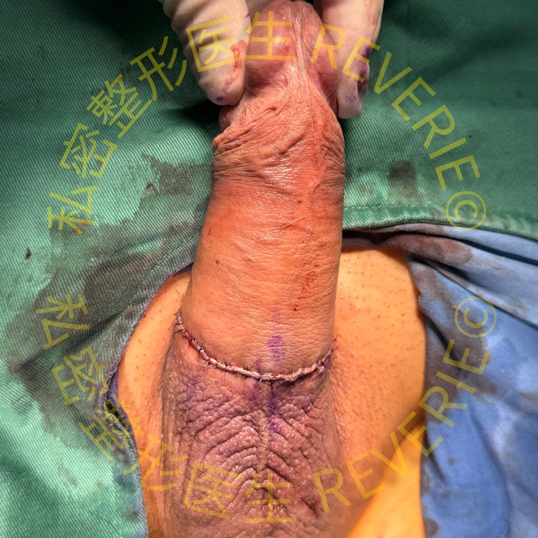 整形医生 RÉVÉRIE tweet media