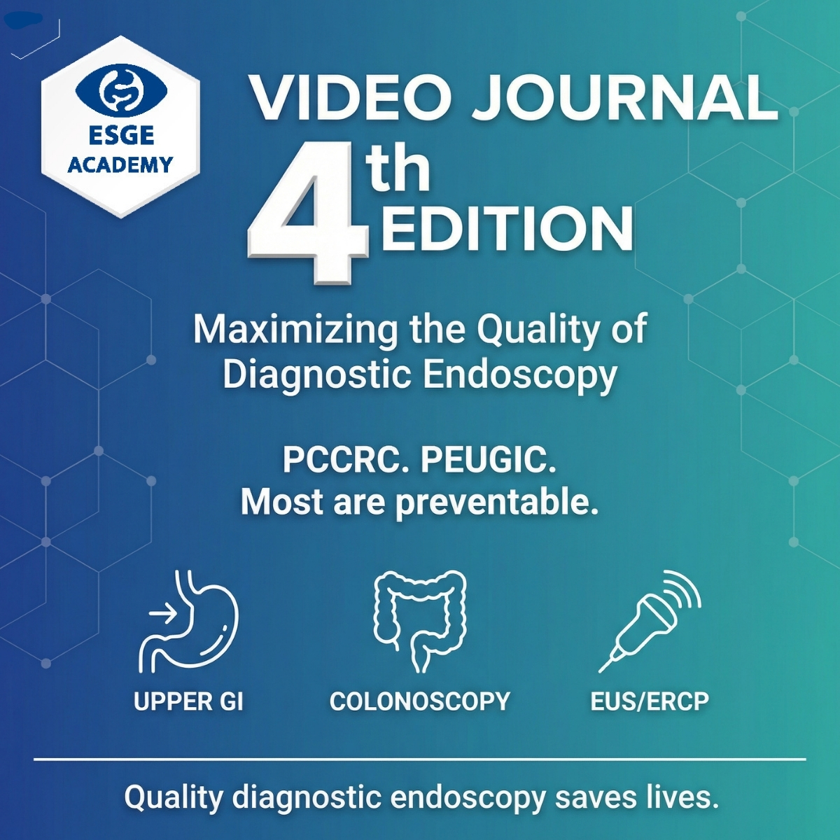 ESGE_news's tweet image. Every "normal" scope that missed a cancer has a name.
PCCRC. PEUGIC. Most are preventable.
🎬Watch our new Academy Video Journal Ed. 4 : Maximizing Quality in Diagnostic Endoscopy
🔗academy.esge.com/en/pages/video…

#GITwitter #endoscopy