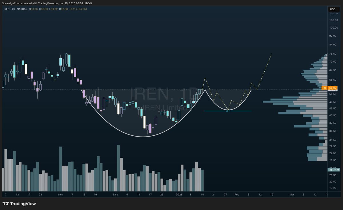 sovereignsense's tweet image. $IREN IFFF there is a pullback (big if) it could turn out to be a solid cup and handle.