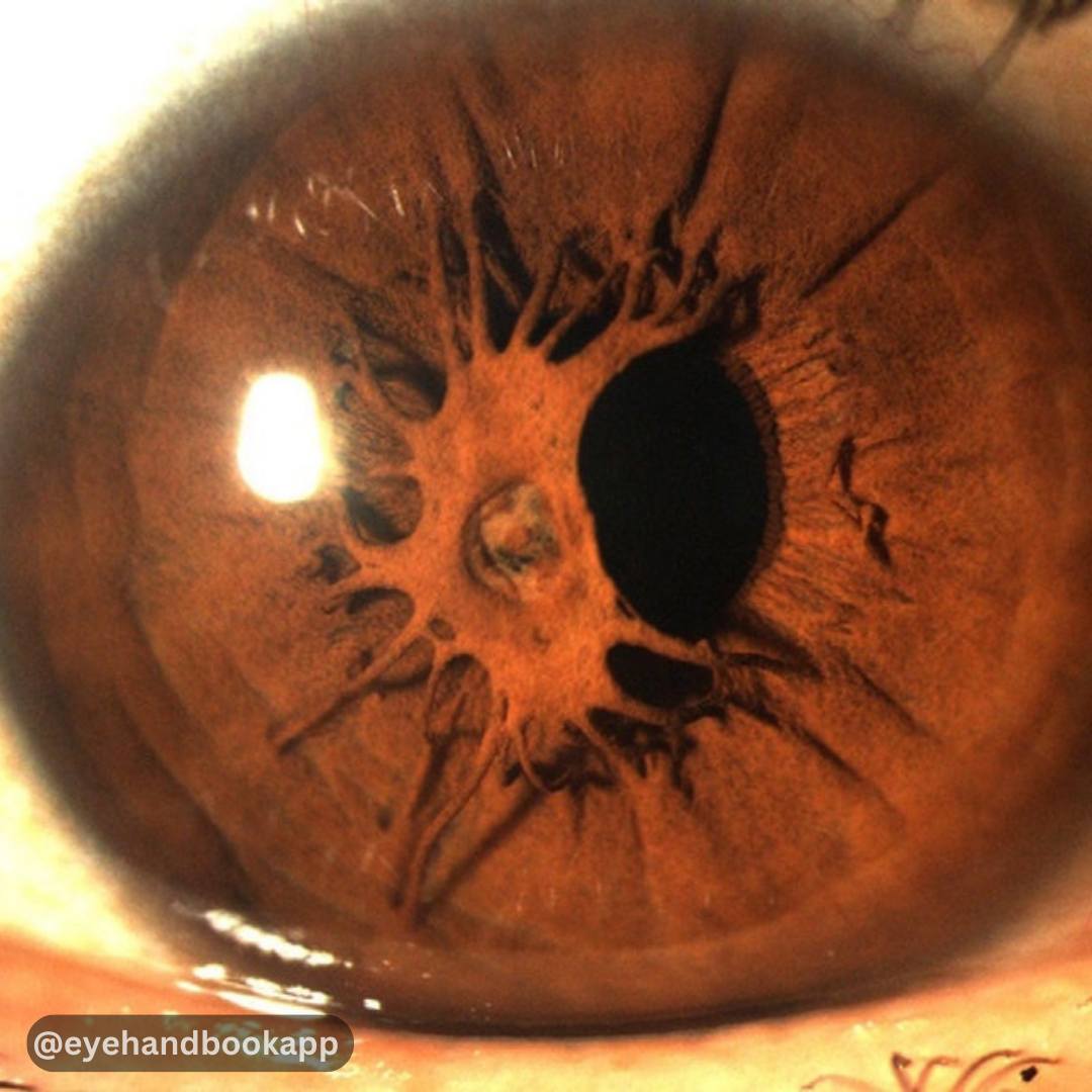 Eye Handbook tweet media