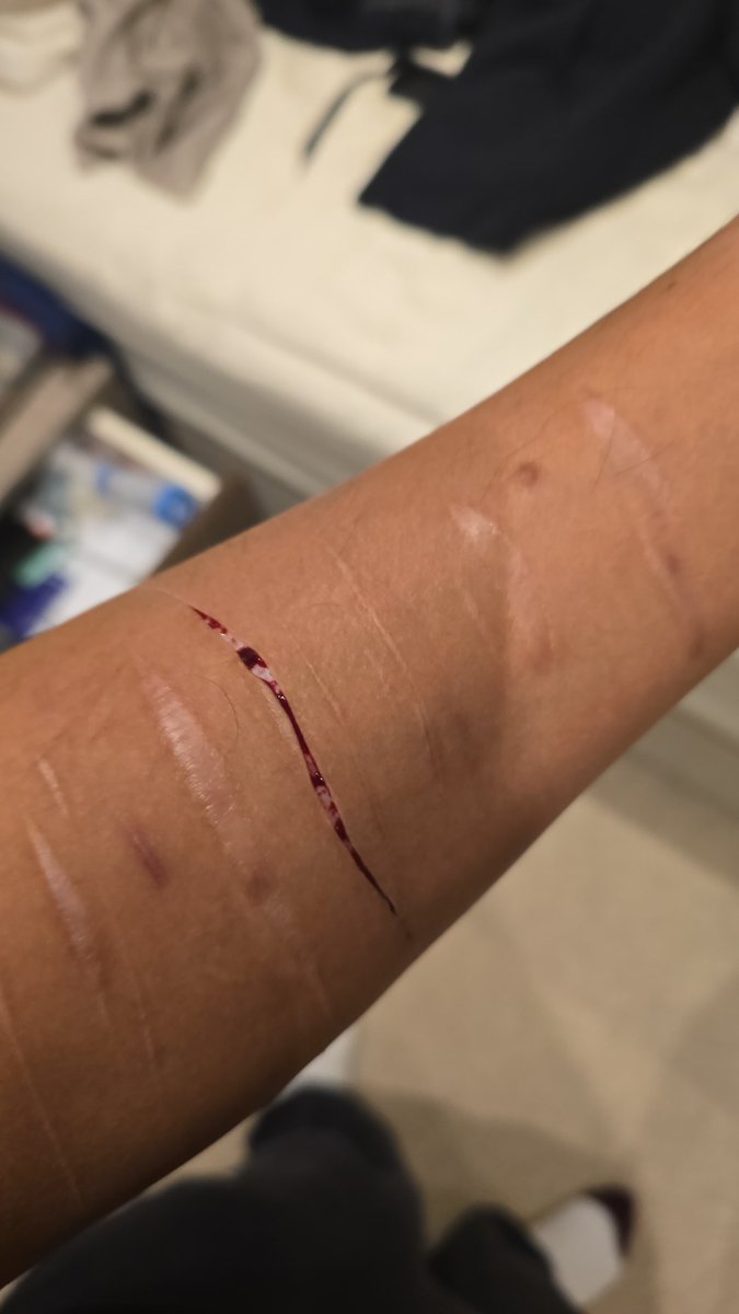 Anonymously2444's tweet photo. Parents are well alive but just dont care.

Im self harming and im alone and dont know who to speak too..... https://t.co/GiREAFNhEa