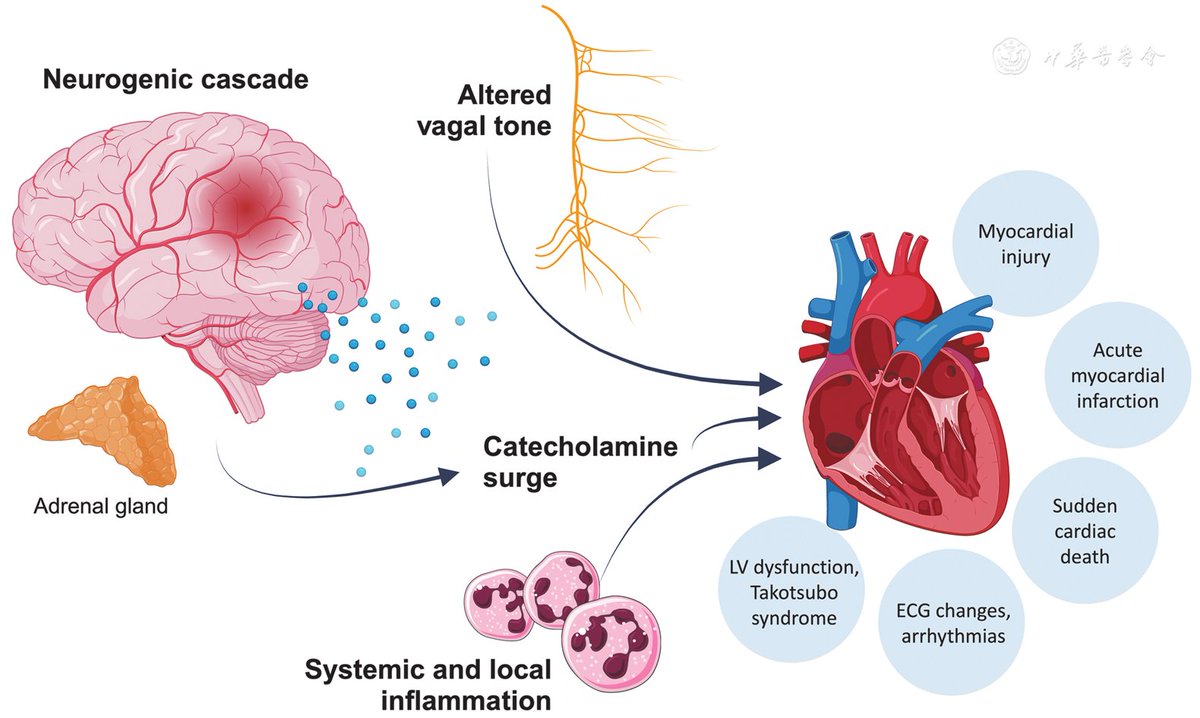 the360upgrade's tweet photo. One of the challenges today is seeing your body as separate parts

It's a whole

Mental disorders i crease cardiovascular risk

Metabolic issues drain hormonal health which worsens metabolic health further
...

So much to gain when you connect these dots https://t.co/9sDe4if2Ac