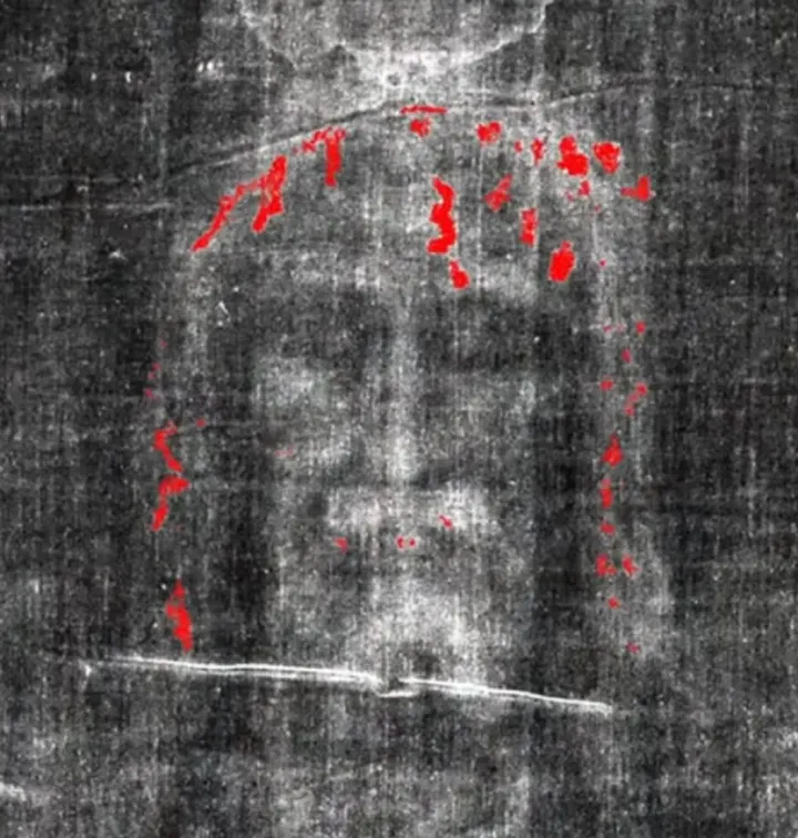 Pildorasdefe's tweet photo. ✅ ¡El Santo Sudario es Real!

La ciencia no puede ni podrá explicar nunca su grabado y que haya permanecido tanto tiempo impreso en esa tela.

En 1988, estudios realizados en la Universidad de Arizona, la Universidad de Oxford y el Instituto Federal Suizo de Tecnología llevaron a cabo la prueba de carbono 14 (C-14), pero resultó ser una prueba no válida

Ellos cortaron una pequeña muestra del Sudario, de unos 3 por 6 centímetros, de la esquina de la tela.

Se analizaron cuidadosamente las muestras para determinar el contenido de carbono y la cantidad de carbono 14 que quedaba. Como resultado, ellos indicaron que databa supuestamente de los siglos XIII y XIV (1260 a 1390 d. C.), lo que sugirieron que se trataba de un engaño de la época medieval.

Pero lo que en realidad sucedió es que la muestra tomada para las pruebas estuvo contaminada a lo largo de los siglos.

✅ ¿Por qué esa prueba no fue válida?

En el Congreso Mundial Sindone 2000, celebrado en Italia, investigadores independientes del Sudario, Joseph Marino y Sue Benford, presentaron un trabajo que abordaba la cuestión del C-14 desde una nueva perspectiva, titulado: "Evidencia de la distorsión de la datación por C-14 del Sudario de Turín debido a reparaciones".

El trabajo sugería que la esquina donde se tomó la muestra había sufrido una reparación previa no documentada y, obviamente, no representaba el resto del lienzo, por lo que no era válido.

Exámenes posteriores revelaron algodón entretejido con lino y un empalme de extremo a extremo en una de las muestras.

También se encontraron indicios de una goma y un tinte aplicados intencionalmente a la superficie de las fibras, aparentemente en un intento de igualar el color de la zona retejida con el del resto de la tela.

✅ Los enigmas del Santo Sudario que la ciencia no puede explicar.

El Sudario de Turín ha sido el artefacto arqueológico más estudiado de nuestro tiempo; más de 100 investigadores interdisciplinarios han llevado a cabo investigaciones primarias sobre él.

Los científicos tienen una fascinación por este Santo Sudario, debido a que nadie puede explicar cómo hay una imagen molecular incrustada en esa tela.

A principios de los años 80, los científicos decían que no hay pigmento, ni tinte, ni pintura alguna. ¿Cómo es esto posible? La ciencia no puede explicarlo hasta la fecha.

Lo más fascinante es que el Santo Sudario está lleno de sangre, y aunque esta se filtra por toda la tela, la imagen es solo superficial, por lo que aparece después de la sangre.

✅ Otros hechos que no tienen explicación.

El Santo Sudario ha sobrevivido al menos a dos incendios ( el de 1532 en Chambéry, Francia, y el de 1997 en la Catedral de Turín ) Incluso fue rociado con agua para extinguir las llamas.

Si se tratara de un simple engaño, la imagen se habría degradado considerablemente, especialmente al estar expuesta al agua, pero aun así permanece intacta. ¿Cómo es eso posible?

La ciencia tampoco lo puede explicar.

✅ Nuevos estudios confirman la verdadera fecha.
 
Recientemente, se publicó un nuevo estudio de investigación basado en imágenes WAXS (imágenes espectrales de gran angular).

Para el nuevo estudio, científicos del Instituto de Cristalografía del Consejo Nacional de Investigación de Italia llevaron a cabo el estudio mediante dispersión de rayos X de ángulo ancho (WAXS).

El WAXS es una nueva técnica que mide el envejecimiento natural de la celulosa del lino y lo convierte en tiempo transcurrido desde su fabricación.

La celulosa está formada por largas cadenas de moléculas de azúcar unidas entre sí que se rompen con el paso del tiempo, lo que indica la antigüedad de una prenda o tejido.

✅ ¿Cómo se realizó ese nuevo estudio?

Para datar el sudario, el equipo utilizó parámetros de envejecimiento específicos, como la temperatura y la humedad, que provocan una importante descomposición de la celulosa.

Los investigadores compararon la descomposición de la celulosa en el sudario con la de otros linos hallados en Israel que datan del siglo I.

Los perfiles de los datos eran totalmente compatibles con mediciones análogas obtenidas en una muestra de lino cuya datación, según los registros históricos, se sitúa entre 55 y 74 d.C., hallada en Masada, Israel [la famosa fortaleza de Herodes construida sobre un lecho de roca caliza con vistas al Mar Muerto]», reza el estudio publicado en la revista Heritage.

✅Ahora, en comparación...

(...) Para que el resultado actual sea compatible con el de la prueba de radiocarbono de 1988, la Sábana Santa debería haberse conservado durante sus hipotéticos siete siglos de vida a una temperatura ambiente secular muy próxima a los valores máximos registrados en la Tierra, reza el estudio.

El autor principal, el doctor Liberato De Caro, afirmó en un comunicado que la prueba de 1988 debe considerarse incorrecta porque "las muestras de tejido suelen estar sujetas a todo tipo de contaminación, que no puede eliminarse por completo del espécimen fechado"...

✅ ¿El sudario tiene una imagen tridimensional?

En la década de 1970, un grupo de científicos especializados en armas utilizó un ordenador llamado Analizador de Imágenes VP-8 para analizar fotografías, incluyendo la de uno de sus nietos, que resultaron con el aspecto de una foto típica (nítida pero plana).

Sin embargo, al introducir la imagen del crucificado del Santo Sudario de Turín, la imagen adquirió una calidad topográfica y tridimensional, donde la luz y las sombras realzaban los contornos del rostro y el cuerpo, como si se tratara de un objeto físico, no de una simple fotografía plana.

El analizador de imágenes VP-8 reveló que la imagen del Santo Sudario posee una calidad tridimensional que ninguna fotografía, y mucho menos ningún falsificador medieval podría haber replicado.

Esta topografía no se puede lograr simplemente con pintura ni otras técnicas medievales típicas.

Para recrearla hoy en día, se necesitaría un cuerpo real para lograr la superposición precisa, sobre todo considerando la perfecta alineación de la imagen con los contornos del rostro y el cuerpo de la persona.

✅ ¿Cómo se sabe que la figura del sudario había sufrido mucho?

Un estudio hematológico detectó altos niveles de bilirrubina en la sangre del Santo Sudario, una reacción desencadenada por un trauma extremo.

Esto explica por qué la sangre permaneció roja en lugar de oscurecerse con el tiempo.

Asimismo, en un informe hematológico más reciente, se examinó la evidencia de sangre en el Santo Sudario e identificaron partículas de hemoglobina y creatinina compatibles con un traumatismo grave y una lesión muscular.

El Santo Sudario de Turín es real, y es la imagen de Cristo mismo.

!Viva Cristo Rey! 👑