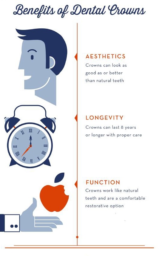 A #dentalcrown covers the entire #tooth and is permanently bonded into place. Learn about the benefits. [#Infographic]