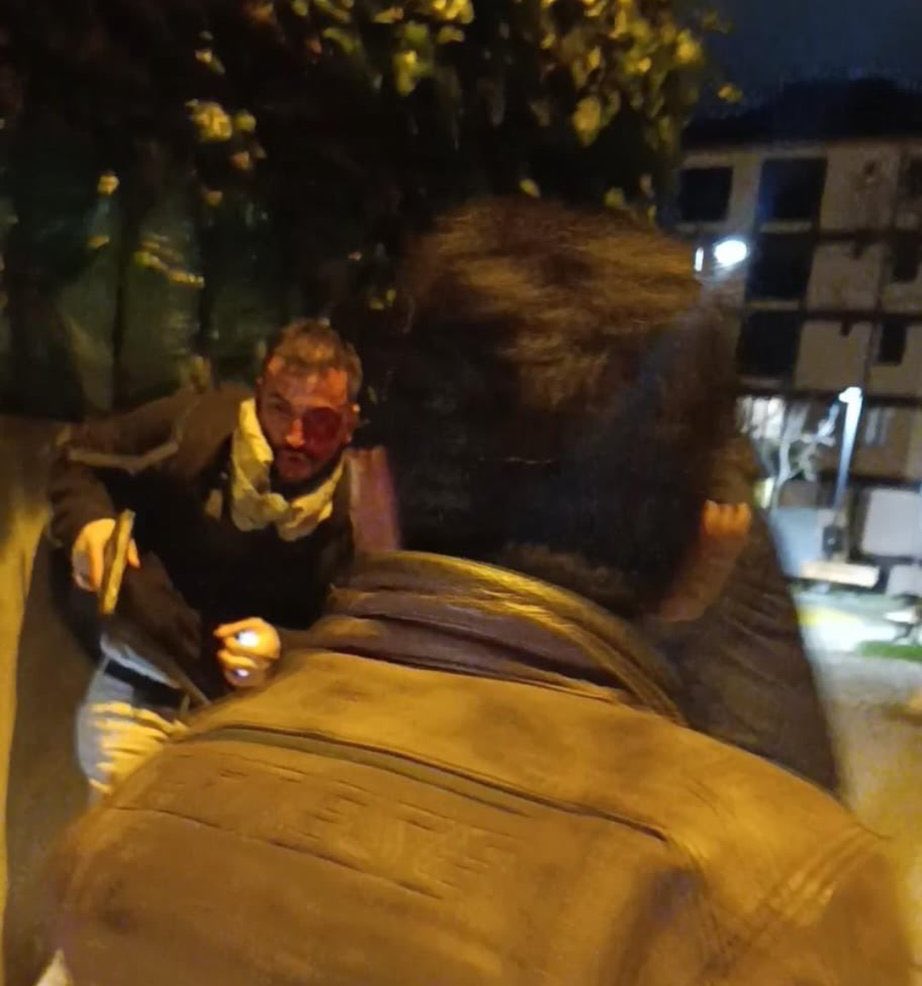 Geçmişte sevgilisini ve şehit ailelerini dolandıran, genç kadınlara şantaj yapan Daily Türkist'in adminlerinden Kürşat Mete, girdiği silahlı kavgada bıçaklanarak yaralanmıştı.

Kürşat Mete'nin kavgada kullandığı silahın başka bir olayda kullanıldığı ortaya çıktı.

Ayrıca Kürşat