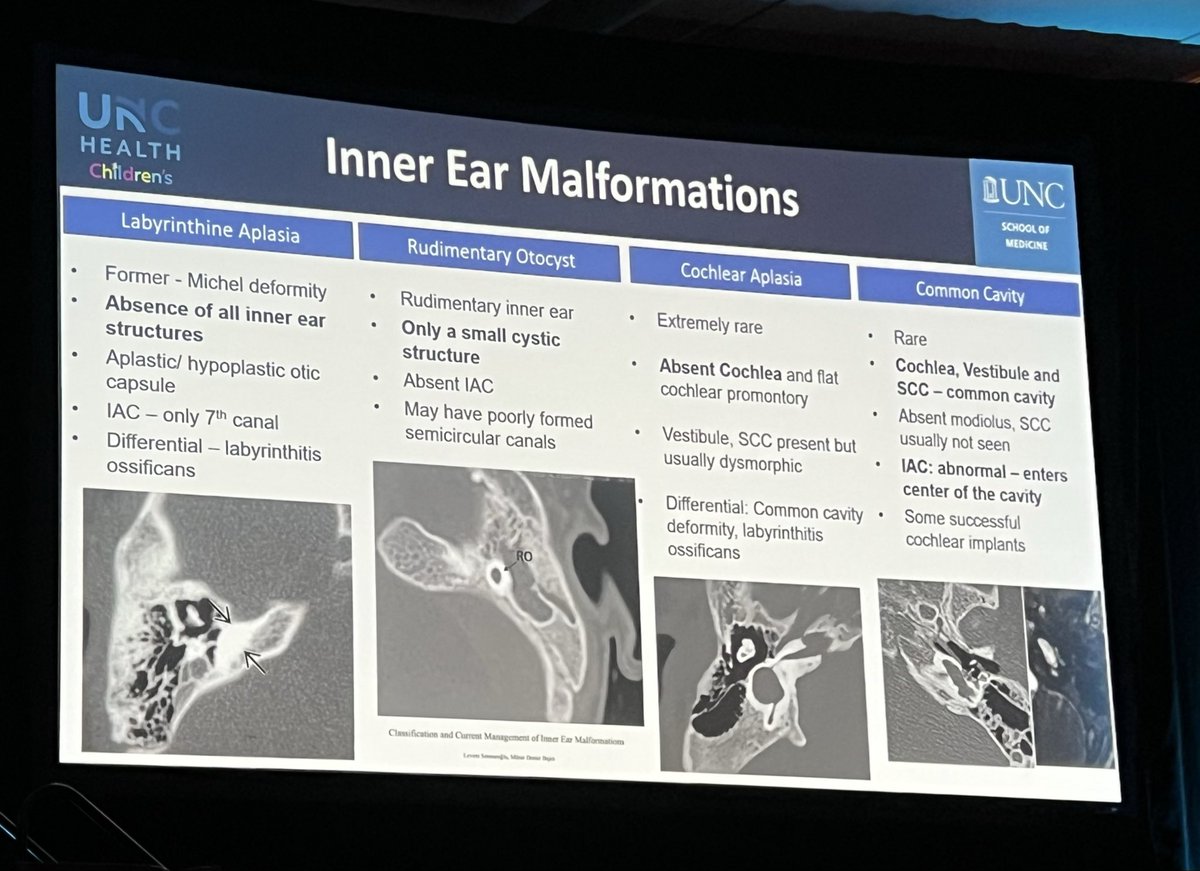 ✨Core Curriculum Session VI ✨ 
Dr. Carolina Guimaraes of University of North Carolina at Chapel Hill continues with a great talk on Congenital Causes of Sensorineural Hearing Loss! 
#ASPNR26 #pedineurorad #pedsrad #radres #MedEd