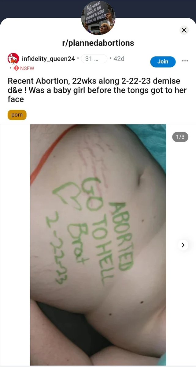 ZELLKLUMPEN's tweet image. r/plannedabortions would like to have a word.