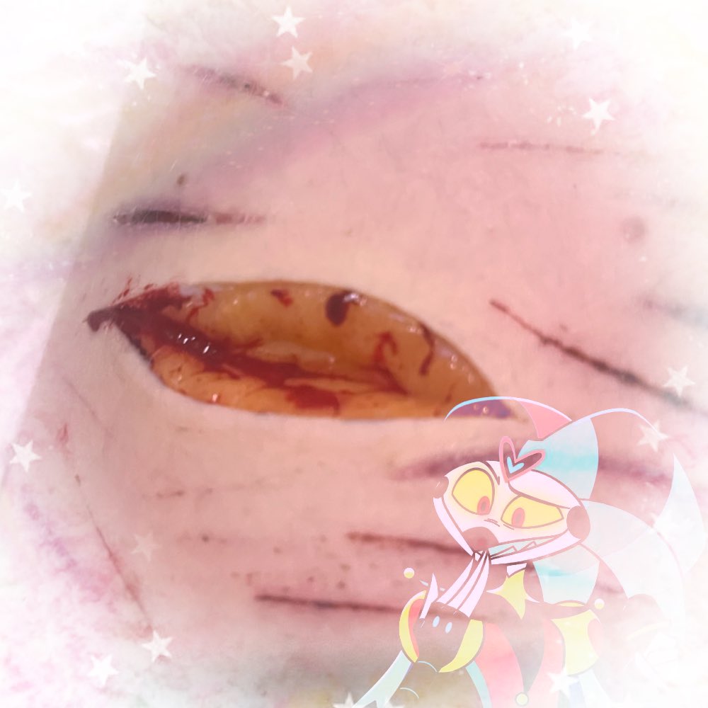 𑣲 𝓐𝒍𝒂𝒔𝒕𝒐𝒓 of shtwt 🦌𐔌༢ེུ tweet media