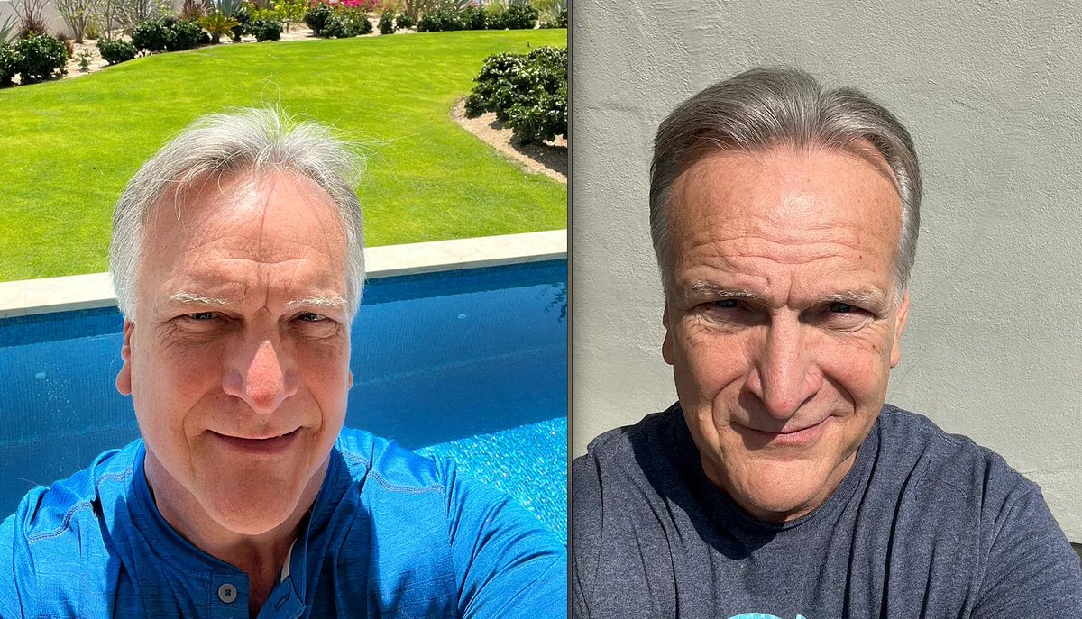 Apparently my 10+ year regiment for anti-aging is turning into reverse aging, at least it looks that way.