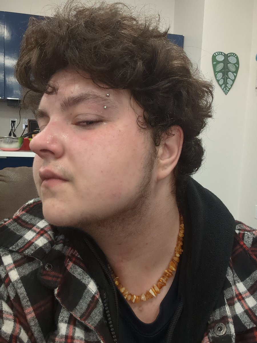 TomatoBricked's tweet image. Update. I am currently now homeless. I cannot under any circumstances give details for my safety. I believe my jaw is fractured, as is two of my fingers. I cannot talk about much. I no longer live with my father. Please help. I do not know what to do.