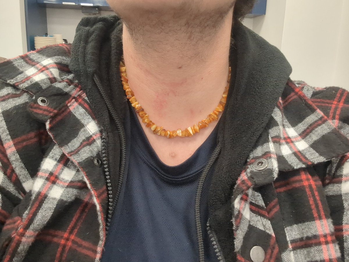 TomatoBricked's tweet image. Update. I am currently now homeless. I cannot under any circumstances give details for my safety. I believe my jaw is fractured, as is two of my fingers. I cannot talk about much. I no longer live with my father. Please help. I do not know what to do.