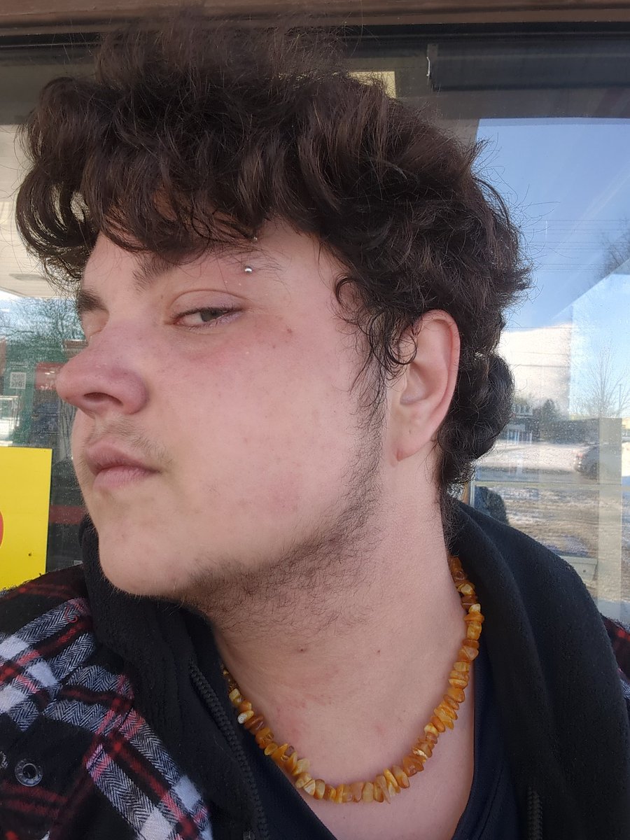 TomatoBricked's tweet image. Update. I am currently now homeless. I cannot under any circumstances give details for my safety. I believe my jaw is fractured, as is two of my fingers. I cannot talk about much. I no longer live with my father. Please help. I do not know what to do.