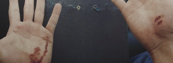 𝑭𝒓𝒂𝒏𝒌 𝑳𝒐𝒏𝒈𝒃𝒐𝒕𝒕𝒐𝒎. tweet media