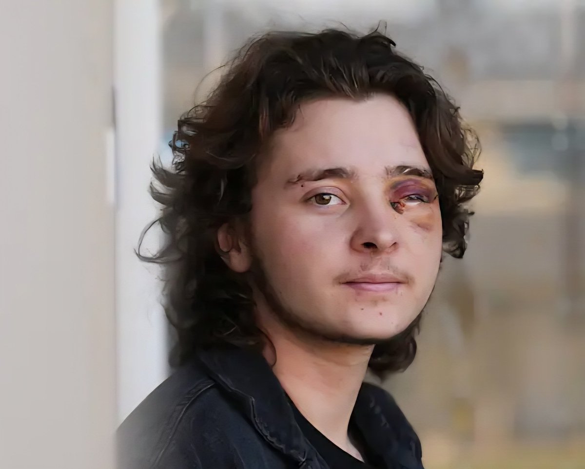 MeinGottNiles's tweet image. Called it. More trans violence. Sad!