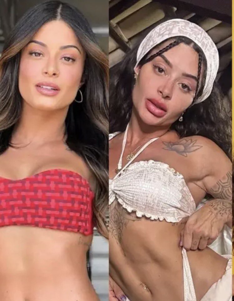 E ainda tem otario dizendo que isso aqui foi processo natural de envelhecimento/bons hábitos, vão tomar no cu, ela é o retrato dessa sociedade dissociada e doente mental por culpa das redes sociais e pressões estéticas impostas por babacas!