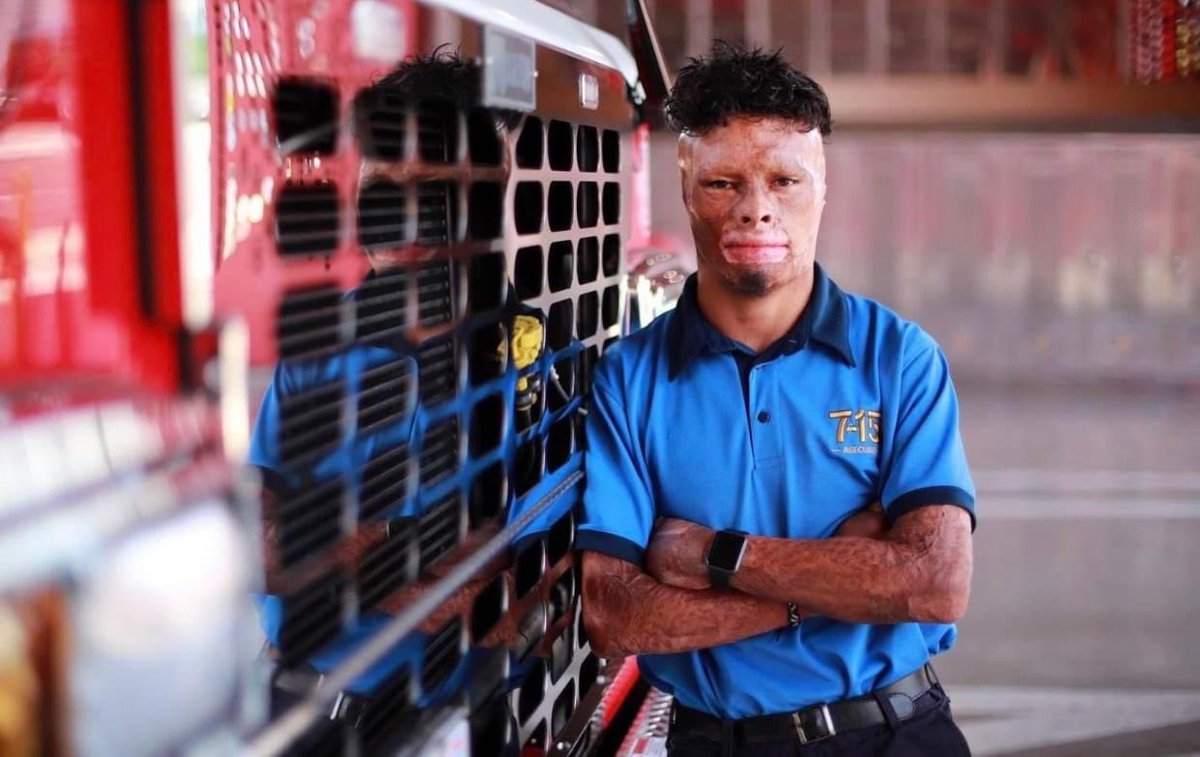 HumanityChad's tweet image. A fire burned 97% of this guy’s body when he was a child. Now he's a firefighter saving lives. 🫡❤️