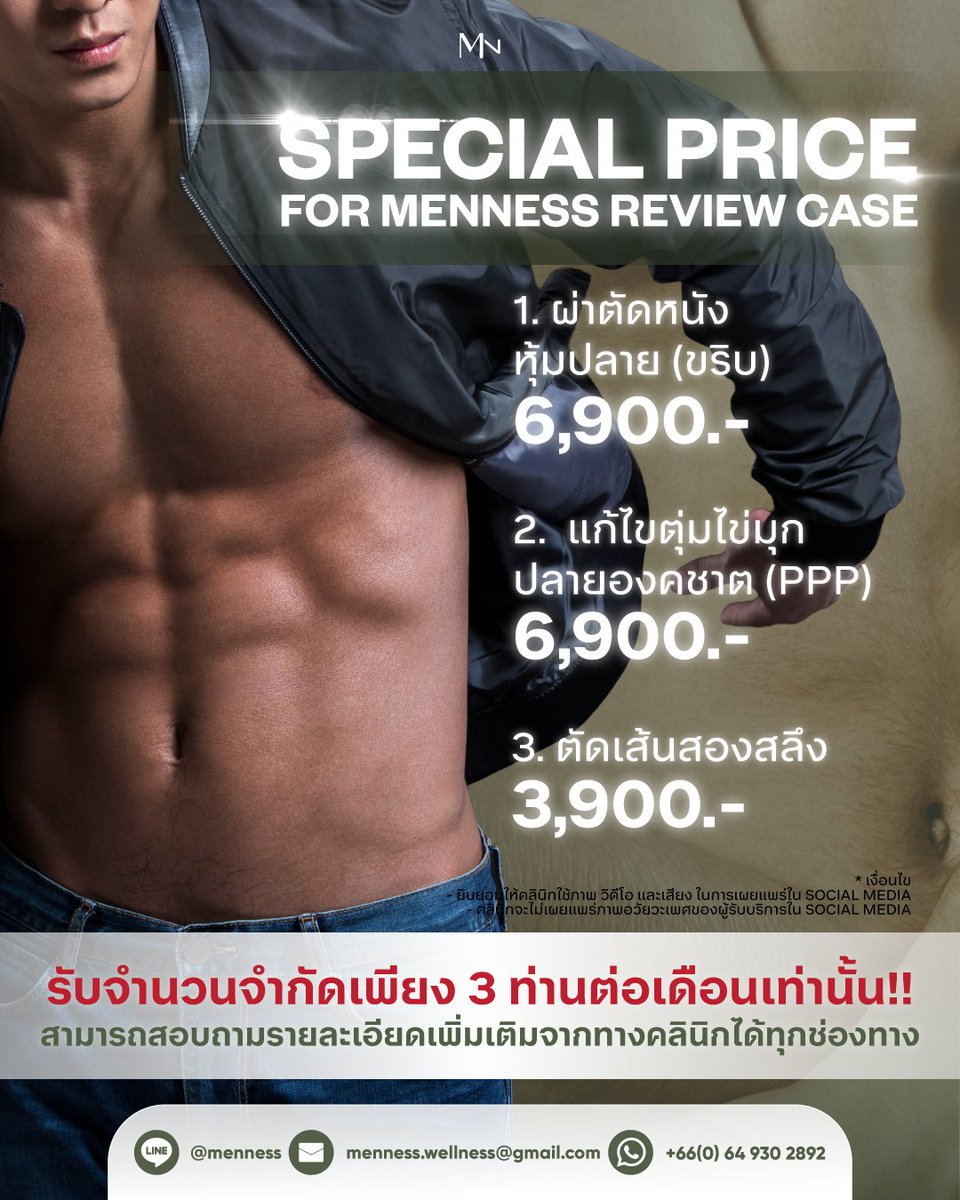 ✨🔥 SPECIAL PRICE สำหรับเคสรีวิว Menness Clinic 🔥 โอกาสพิเศษสำหรับคุณผู้ชายที่อยากดูแลตัวเองแบบคุ้มค่า ด้วยบริการจากคลินิกในราคาสุดคุ้ม!
.
✔ ผ่าตัดหนังหุ้มปลาย (ขริบ) เพียง 6,900.- (ปกติเริ่มต้น 16,900.-)
✔ แก้ไขตุ่มไข่มุกปลายองคชาต (PPP) เพียง 6,900.- (ปกติ 24,900.-)
✔