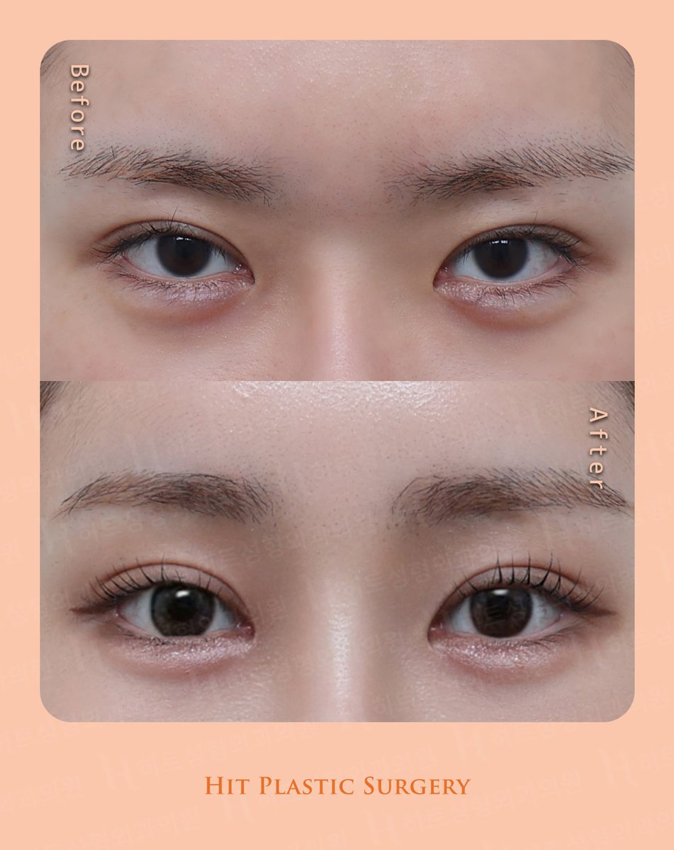 ヒット整形外科 tweet media