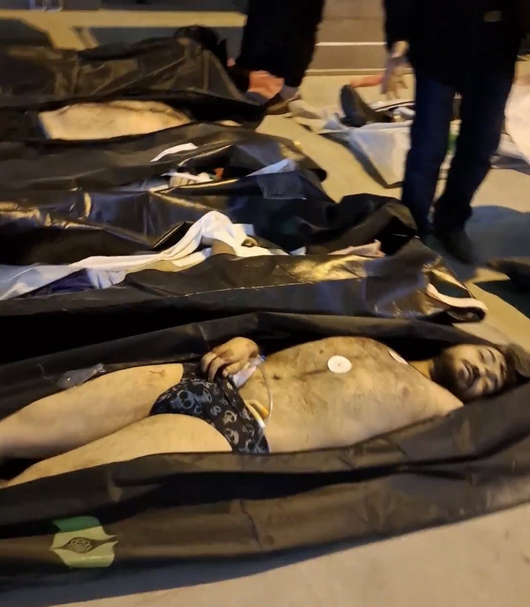 MOSSADil's tweet image. ⚠️ GRAPHIC CONTENT WARNING
IRAN: Questions raised by hospital evidence in fatal shooting case

The image shows an adult man still connected to hospital monitoring pads and medical tubing, indicating he was under active medical care.

Yet, he shows signs of been fatally wounded…