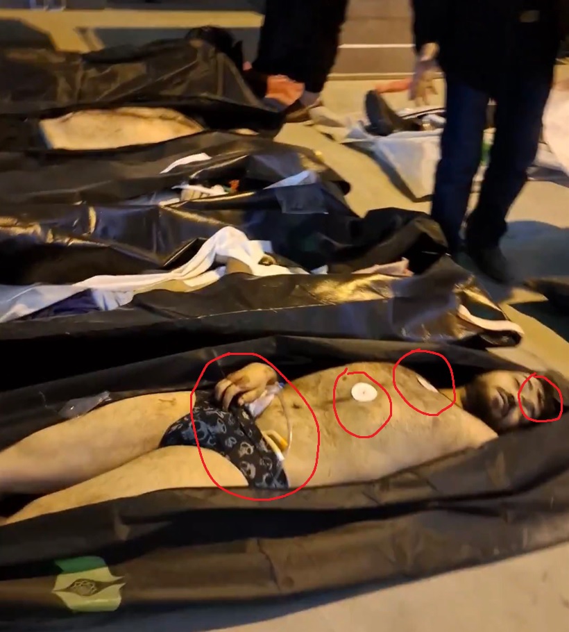 Realneo101's tweet image. Proof: The Islamic Regime is dragging wounded patients out of hospital beds and executing them with point-blank headshots.

THIS MUST GO VIRAL.

#IranMassacre