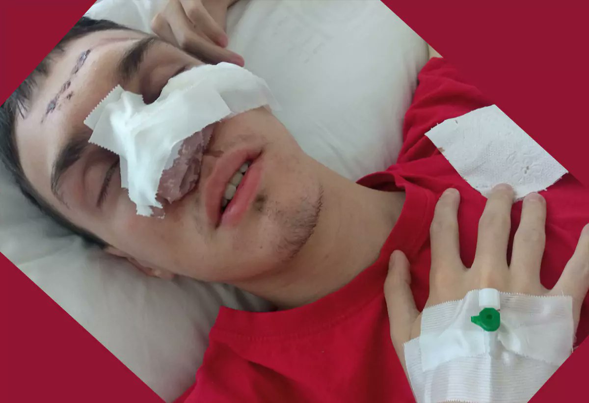 bianconerobgd's tweet image. Kaže Aca, divljaci bacali grudve na Anu Bekutu ( naravno,bez ikakvih posledica ). 
Aco Srbine, šta su onda pripadnici žandarmerije? 🤔