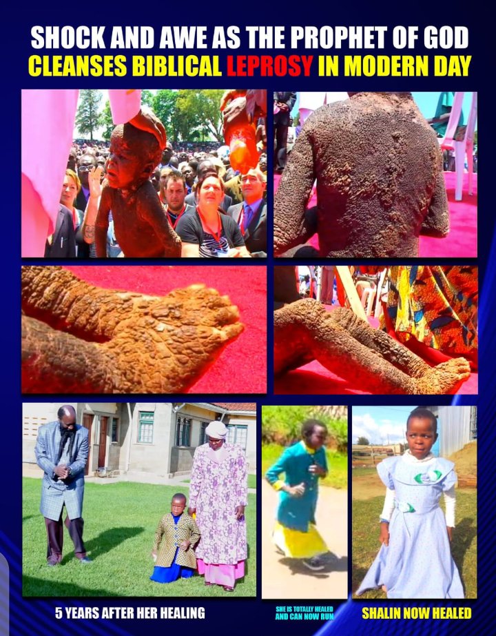 moureen_kc's tweet image. In a generation where hope is fading, God is revealing His power again. Jesus is making the impossible possible. These are not stories of the past—they are signs of the times. The sick are healed, the captives are set free, and faith is being restored. 🔥🙌
#MiraclesOfTheEndTime