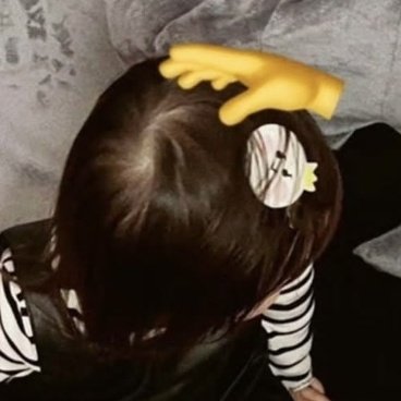 chipnuna's tweet image. pake jepit yochiii😭🤏