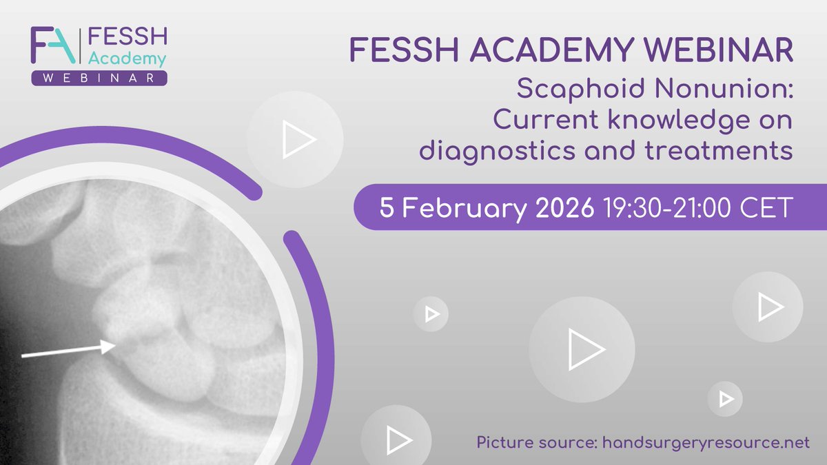FESSHEurope's tweet photo. Why is scaphoid nonunion still one of the toughest challenges in hand surgery? Join the next #FESSH Academy Webinar, in collaboration with the Danish Hand Surgery Society for practical insights into diagnostics, surgical techniques and long-term outcomes! https://t.co/1QuV3S69GS https://t.co/1ATu7feYaD