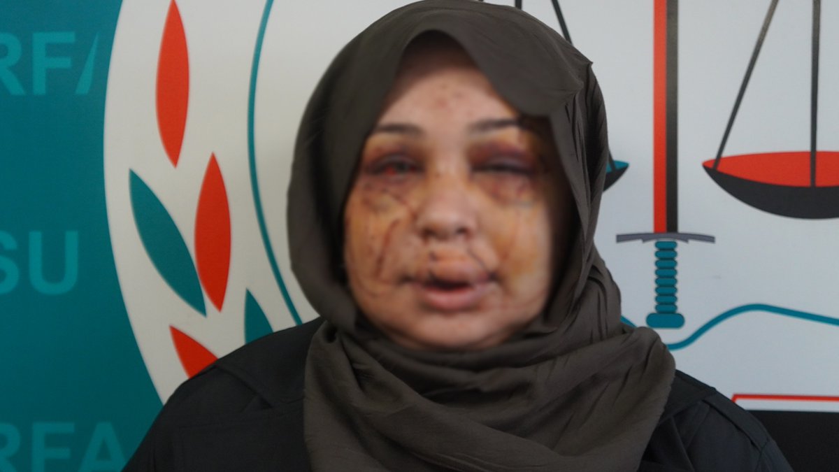 Polis eşi tarafından darbedildiği iddiasıyla şikayetçi oldu

'Vicdanı olan herkesten yardım istiyorum'
cumhuriyet.com.tr/turkiye/polis-…