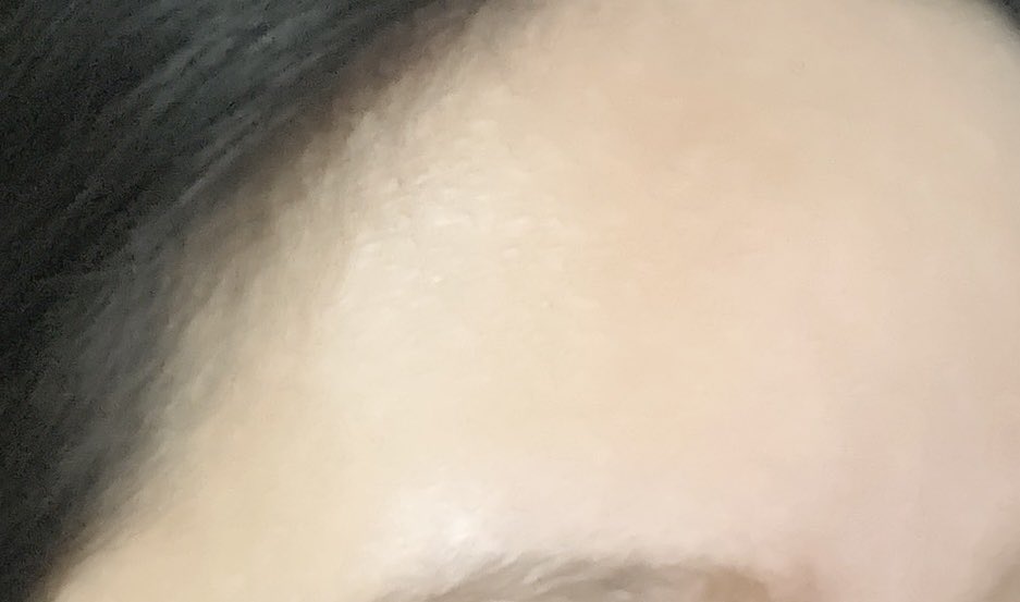 yegubes's tweet image. เริ่มต้นต้นปีด้วยสิว+รอยแดงหายไปแล้ววว กินหมดไป 3 กล่อง (วันละ 2 เม็ด) ดีอะ ดีมากกกกก ไม่ดันสิวออกมาด้วย นี่กดสิวก็คือช่วยรอยจางไปเยอะ skincare ใช้แบบเดิม แต่กินก็ช่วยเพิ่มให้ผิวดีขึ้น