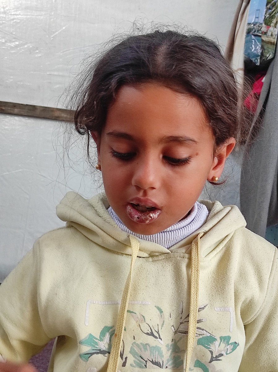 Ibrahimham72401's tweet image. "My daughter is suffering so much 💔
From painful fungal infection in her mouth, along with the flu and a severe cold… the pain never leaves her.
We ask for your help, even if only a little your support could save her and ease this pain 🙏
gofund.me/f8401cef
@Louis_Allday
