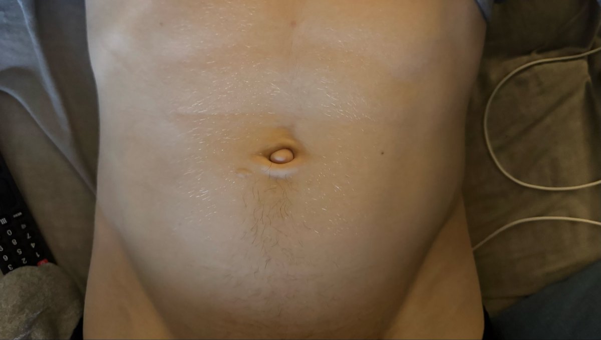 Jim Koopar tweet media