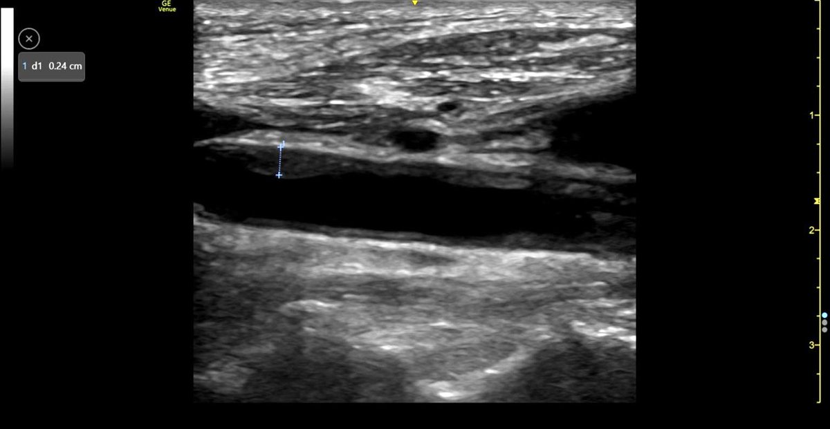 Mohan Sai Gudela, DM tweet media