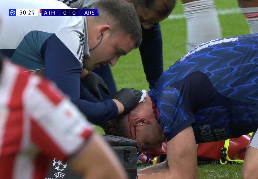 Gyökeres is bleeding. #ATHARS
