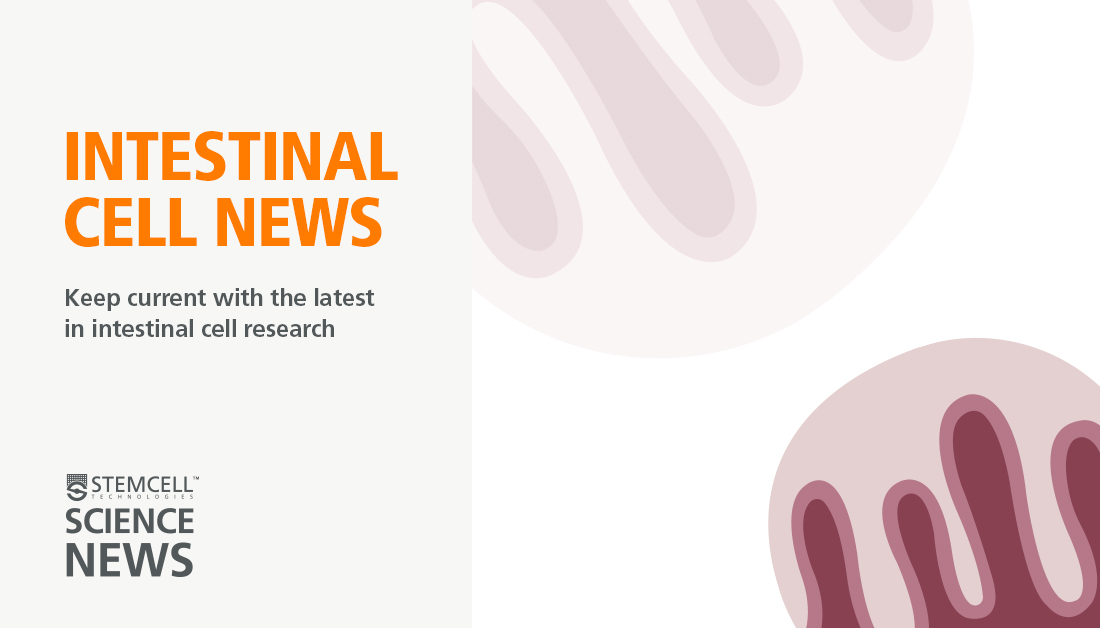 Intestinal_Cell's tweet image. Stay current on colorectal cancer, IBD, and #colitis research. 💡
Intestinal Cell News delivers weekly #intestinal research highlights straight to your inbox.
🔔 Subscribe for free: bit.ly/4kkWMEu