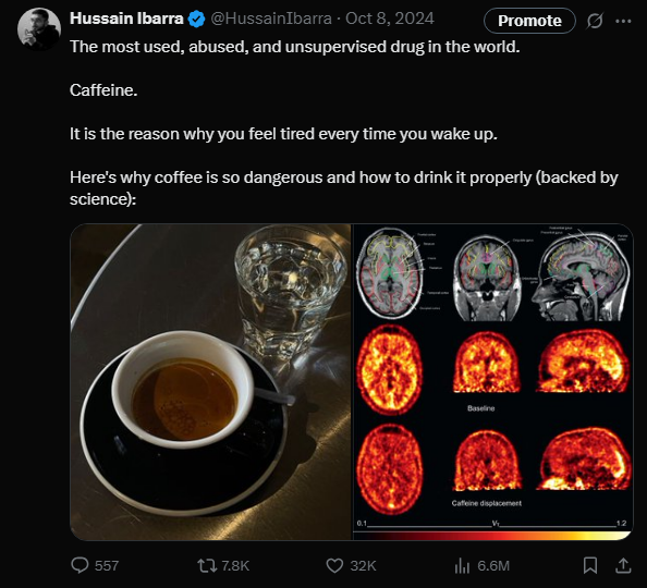 Hussain Ibarra tweet media