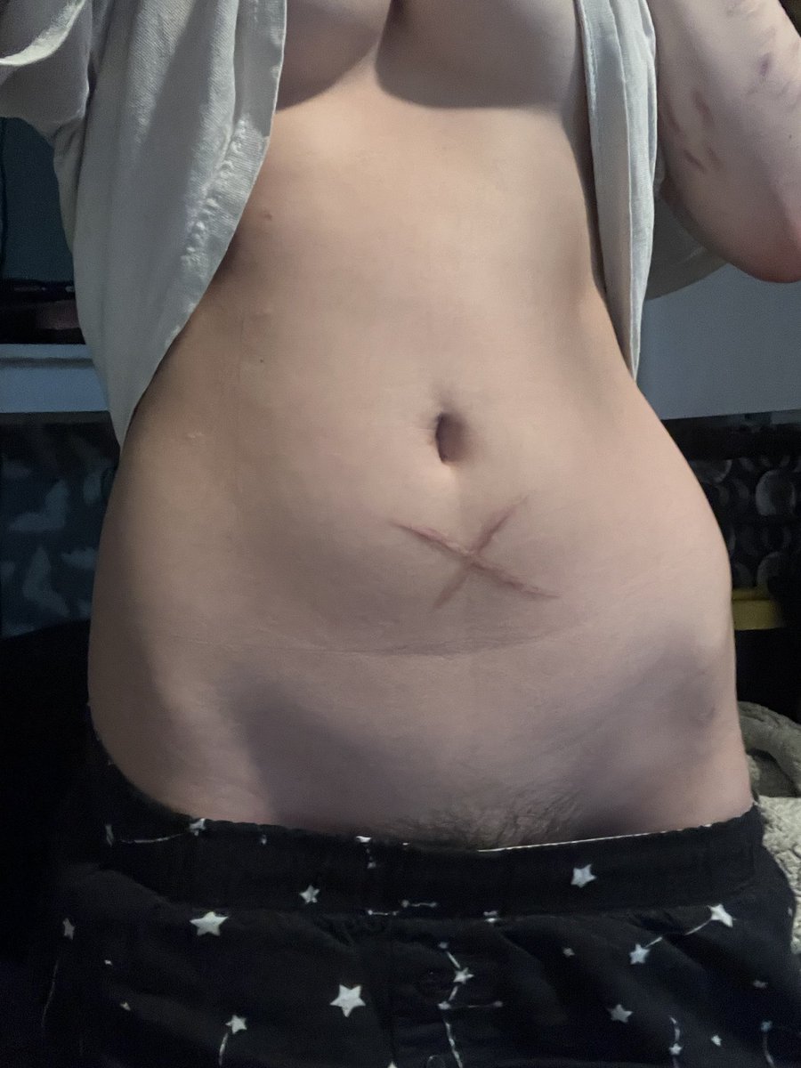 My tummy isn't that big but ima participate anyway... 👉👈