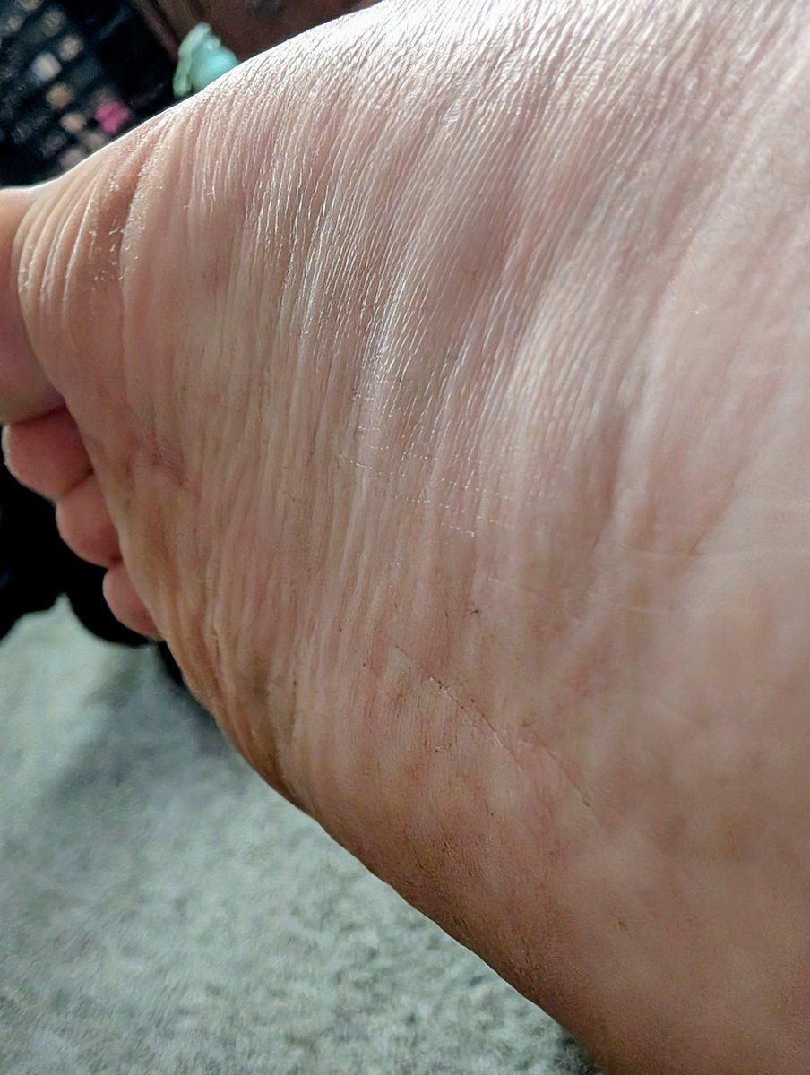 -UPDATE POST-

I am thankfully moved in and have successfully avoided homelessness and have started to get my health in check, thanks to all your guys' help! Whether you donated or reblogged or liked, I can't thank you enough for your support.

More content is to come!~ 💛
-Poppy