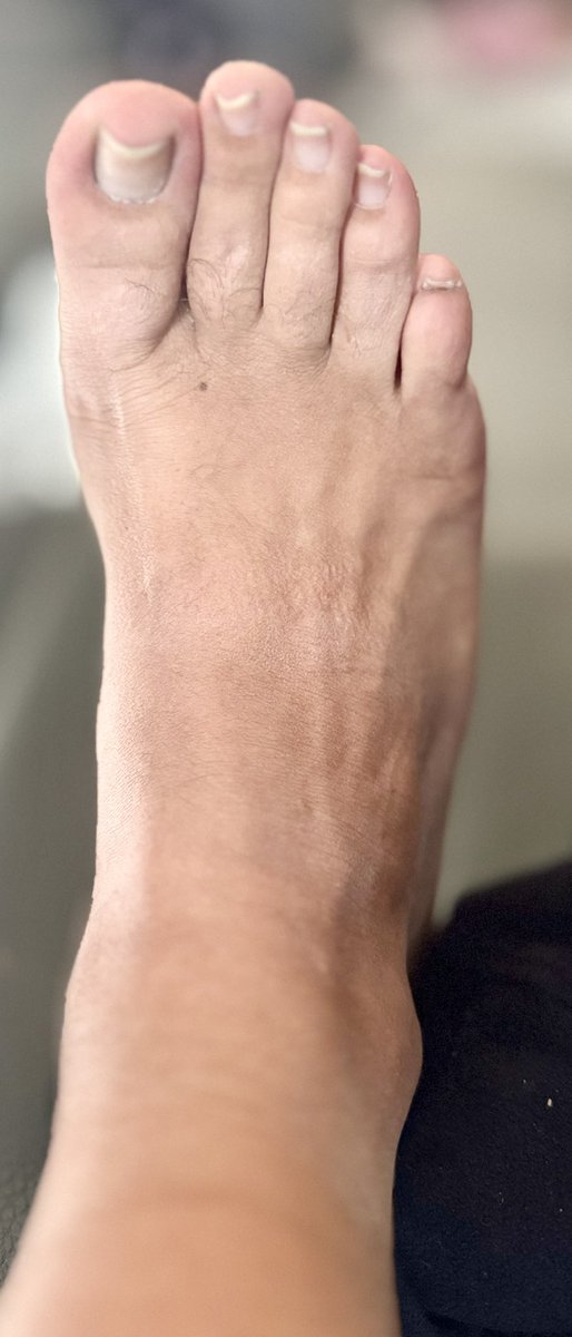 YourManForFun's tweet image. If 2 feets can Make 15k likes what can do 1 feet 
#add #me