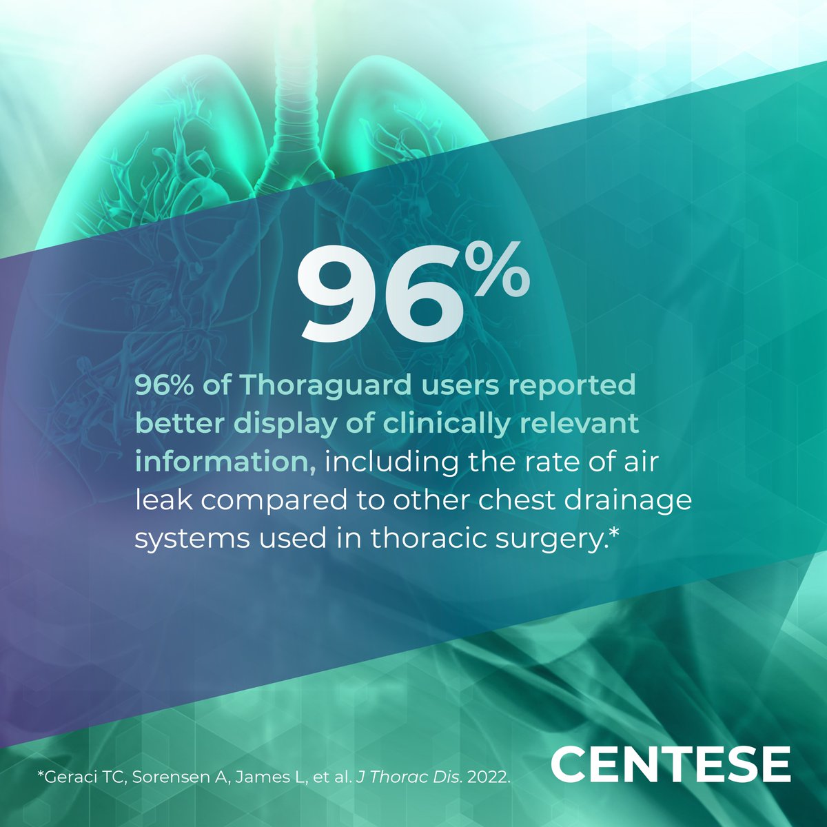96% of users report better display of clinically relevant data, including real-time air leak rates and fluid output trends,* Thoraguard is proven to deliver smarter data for faster decisions.
Visit Centese.com and see why surgeons are making the switch!
*Geraci. 2022.