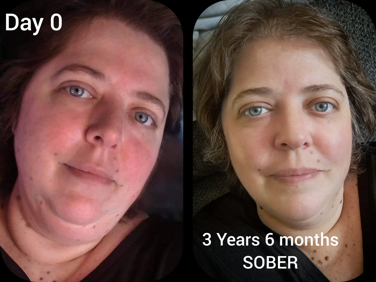 wndr81's tweet photo. 3 years 6 months SOBER today
(Day Zero to Today no filters, just life)
#sober #sobriety #alcoholfree #boozefree #odaat #RecoveryPosse #soberlife #nofilterneeded #LifeisBeautiful #faithoverfear #livefree #Happiness https://t.co/MLVSGqHNQH